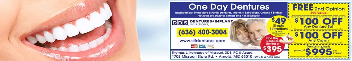 dentures belleville il bridges